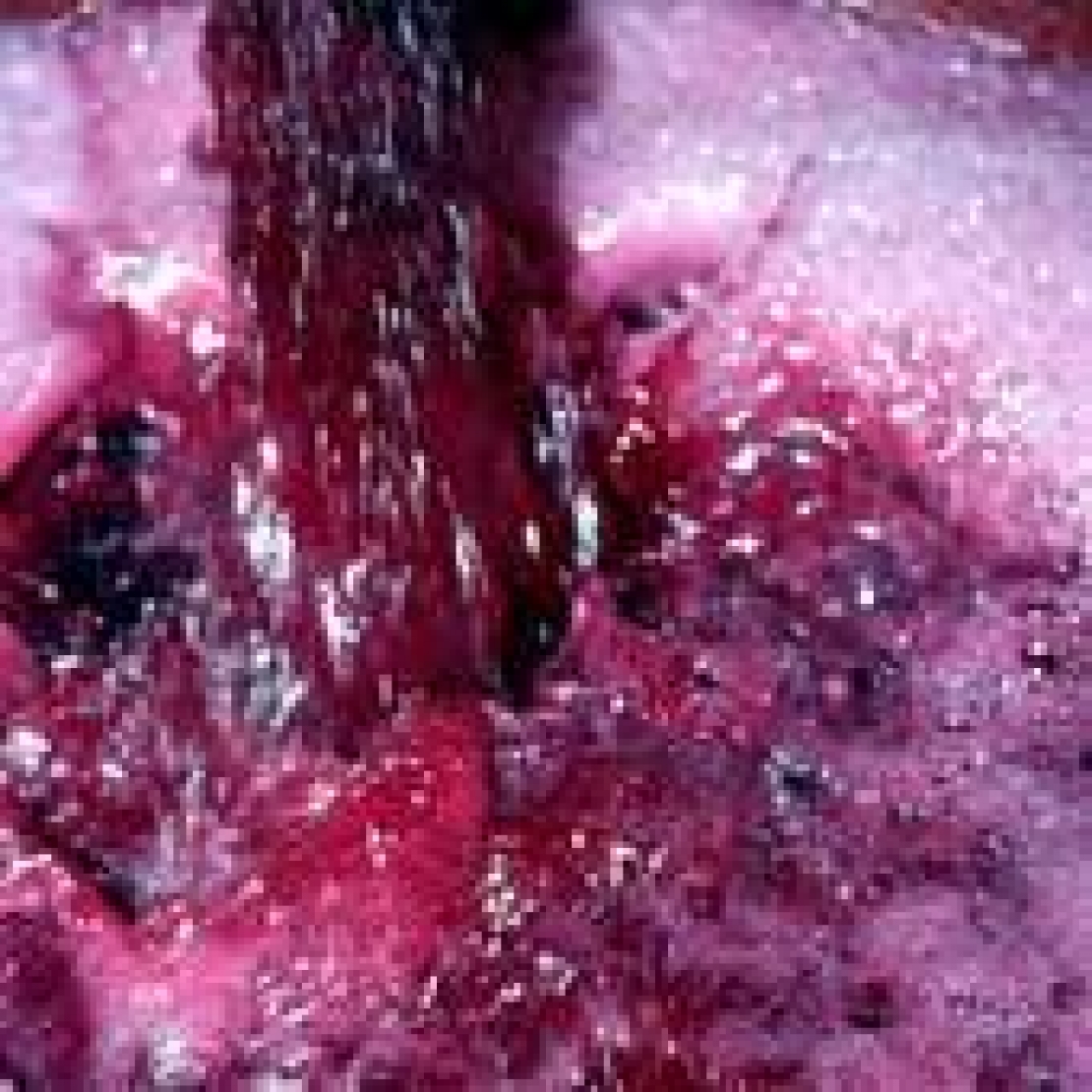Il lievito è fattore determinante per il contenuto di solfiti nel vino