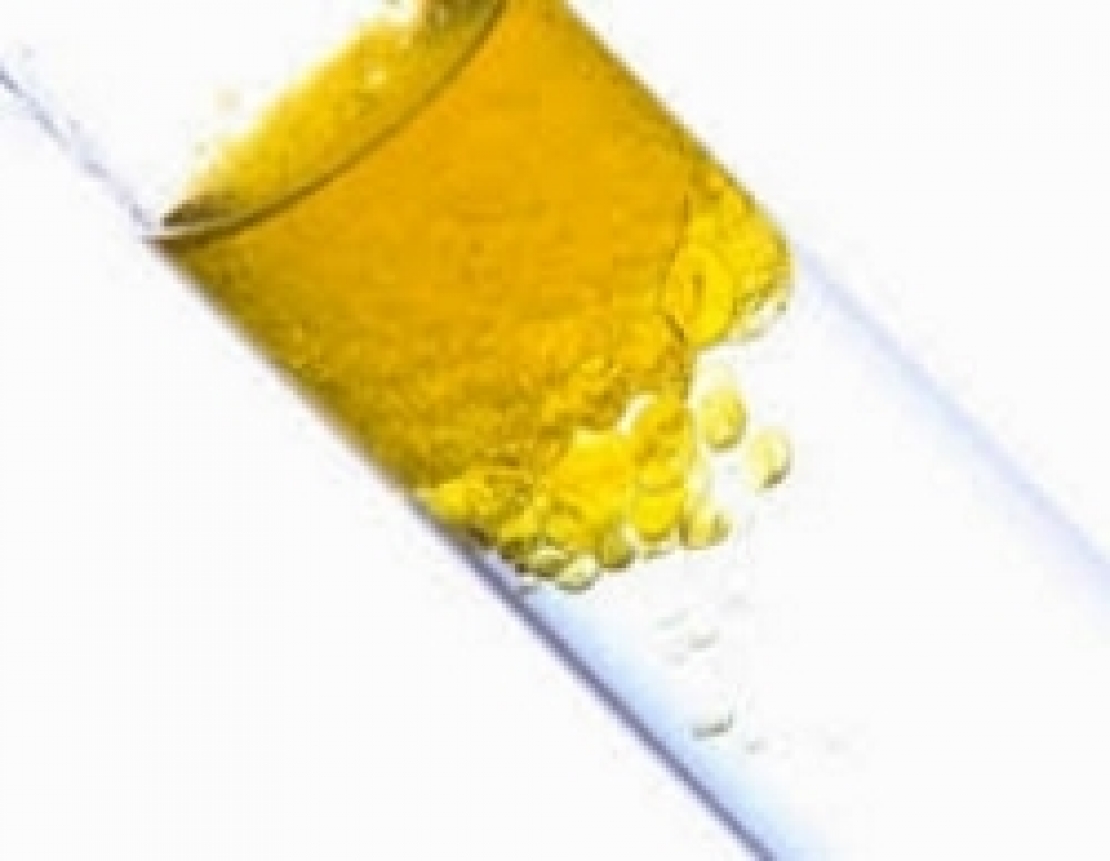 L'olio extra vergine di oliva fa bene alla salute? Merito della biodiversità